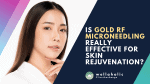 Is Gold RF Microneedling Really Effective for Skin Rejuvenation