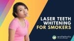 Laser Teeth Whitening for Smokers