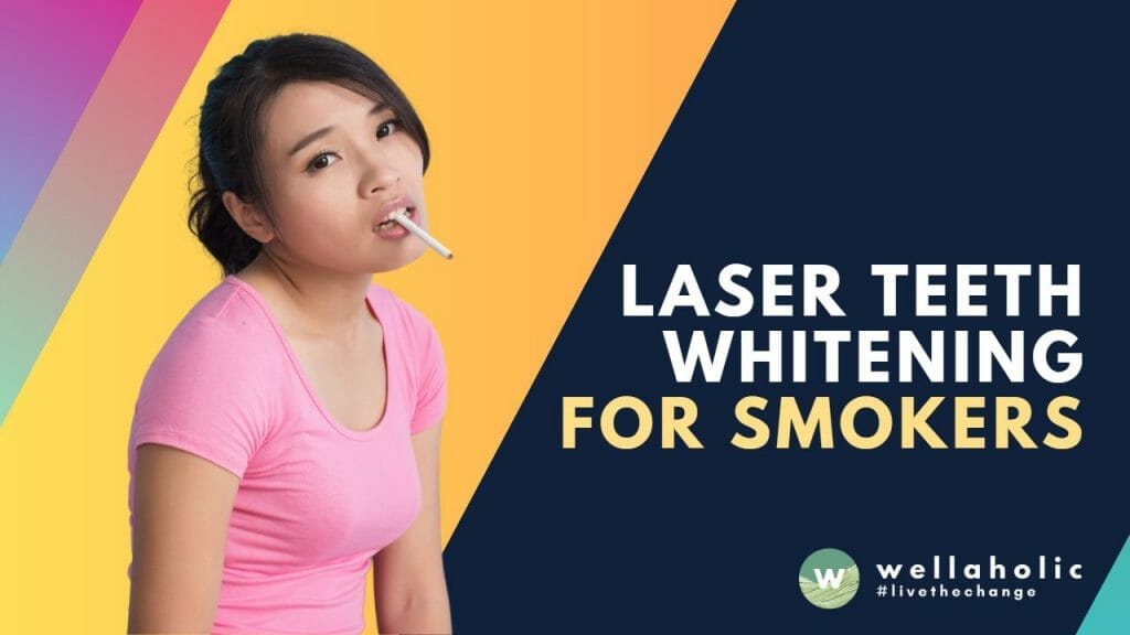 Laser Teeth Whitening for Smokers