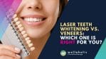 Laser Teeth Whitening vs. Veneers: Which One Is Right for You?