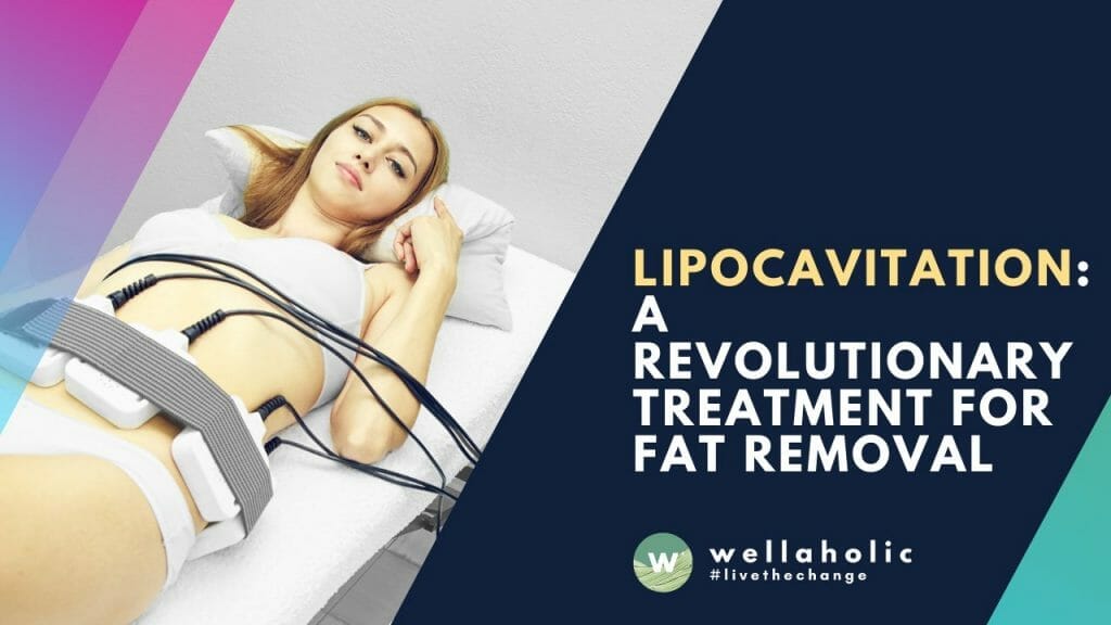 Lipocavitation