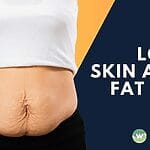 Loose skin after weight loss in Singapore? RF Sculpting firms skin, boosts collagen, and refines contours. See results, safety, timelines, and nett pricing. Start a confident shape plan today.