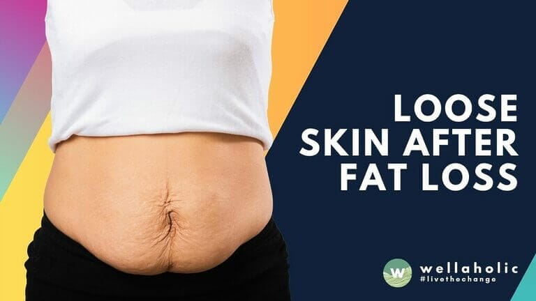 Loose skin after weight loss in Singapore? RF Sculpting firms skin, boosts collagen, and refines contours. See results, safety, timelines, and nett pricing. Start a confident shape plan today.