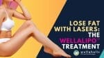 Lose Fat with Lasers
