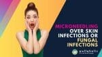 Microneedling Over Skin Infections or Fungal Infections