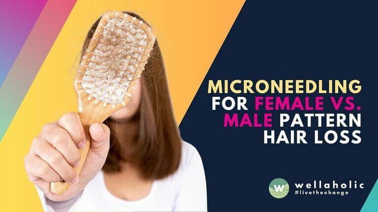 Discover 2025 data on microneedling effectiveness for female vs. male pattern hair loss. Compare results, costs, and treatment protocols. Expert analysis at Wellaholic Singapore.
