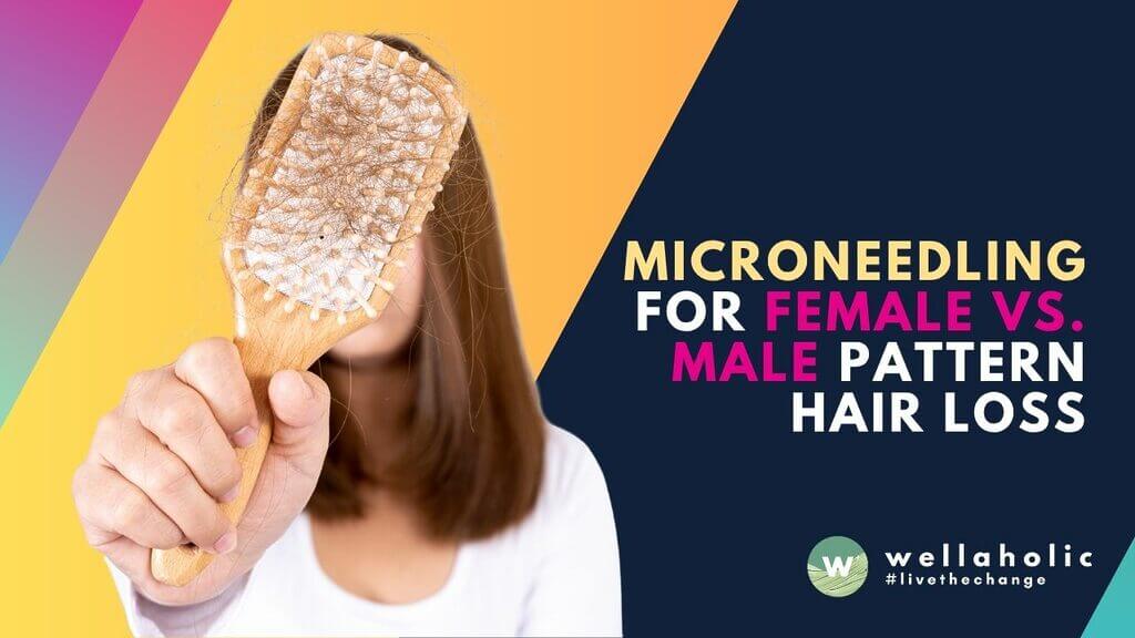 Discover 2025 data on microneedling effectiveness for female vs. male pattern hair loss. Compare results, costs, and treatment protocols. Expert analysis at Wellaholic Singapore.