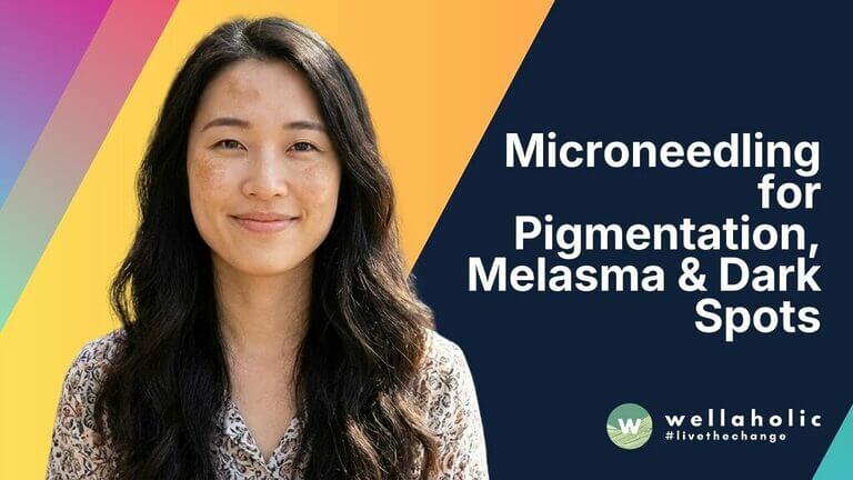 Yes, microneedling clears melasma by breaking up pigment and boosting skin renewal. It is a safe choice for Singapore's sunny climate. Find out why it works. Read our expert guide!