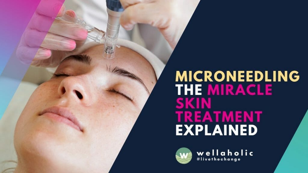 Microneedling: The Miracle Skin Treatment Explained