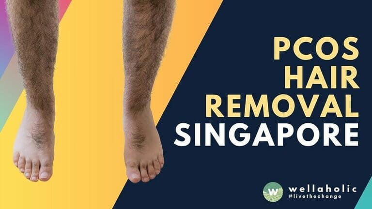 Discover the best hair removal options for PCOS in Singapore, including laser and IPL treatments for permanent reduction of unwanted hair on various body areas.