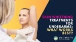 Say goodbye to dark underarms! Discover the best skin whitening treatments that actually work. Don't let hyperpigmentation hold you back - Read on to unveil the key to achieving flawless, even-toned underarms!