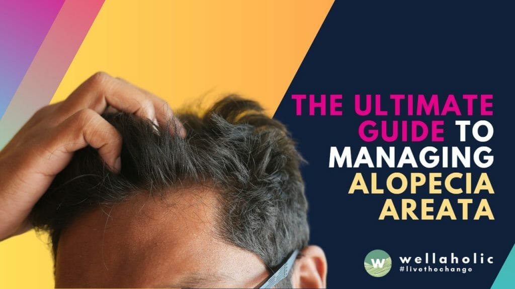 The Ultimate Guide to Managing Alopecia Areata
