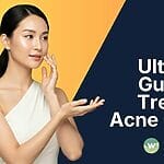 Discover how Gold RF Microneedling effectively clears acne scars and pigmentation on Asian skin with low PIH risk. Prices start from $215 (Nett). Visit our 4 Singapore outlets.