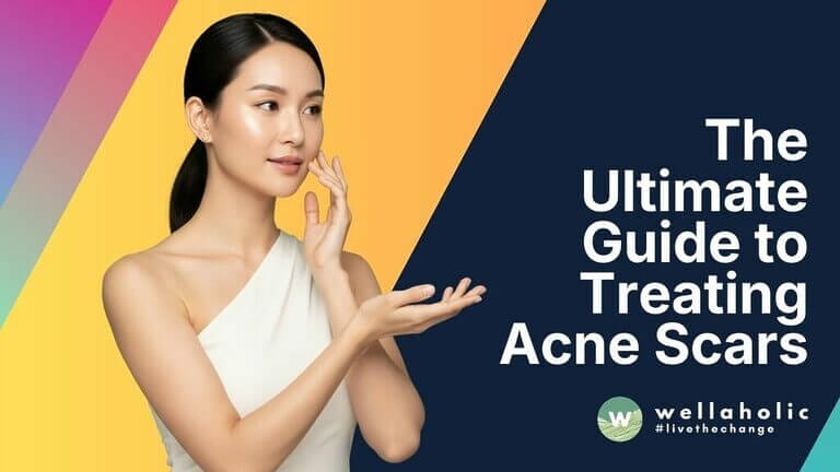 Discover how Gold RF Microneedling effectively clears acne scars and pigmentation on Asian skin with low PIH risk. Prices start from $215 (Nett). Visit our 4 Singapore outlets.