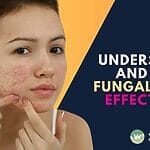 Uncover the truth about fungal acne with Wellaholic's in-depth guide. Learn to identify, treat, and prevent this common yet misunderstood skin condition.