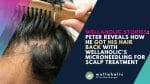 Peter suffered from hair loss and thinning hair until he tried Wellaholic’s Microneedling for Scalp, a collagen induction therapy that stimulates hair growth. Read his story and see his amazing results after 12 weeks of treatment.