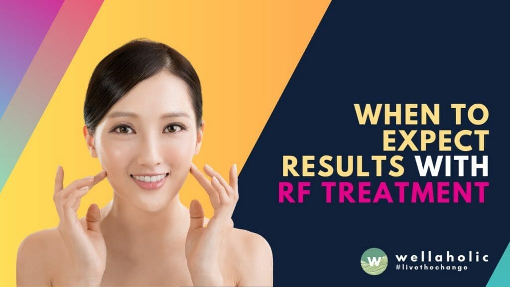 When to Expect Results with RF Treatment