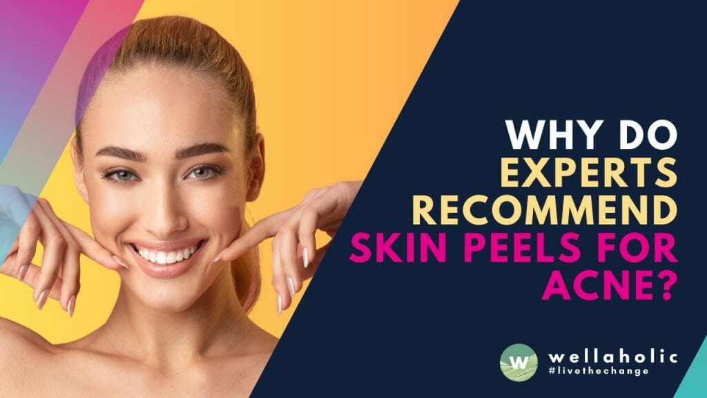 Discover why skin peels are recommended by experts for acne treatment! Say goodbye to stubborn acne and embrace clearer, smoother skin. Explore the science behind skin peels and their transformative effects on acne-prone skin. Get ready to unlock a confident, blemish-free complexion with this powerful skincare solution!
