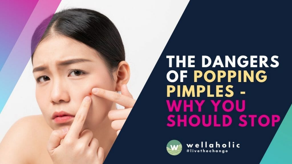The Dangers of Popping Pimples - Why You Should Stop