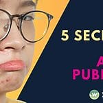 Discover 5 expert tips to banish acne and prevent pimples, even after puberty. Learn effective treatments and lifestyle changes for clear, healthy skin!