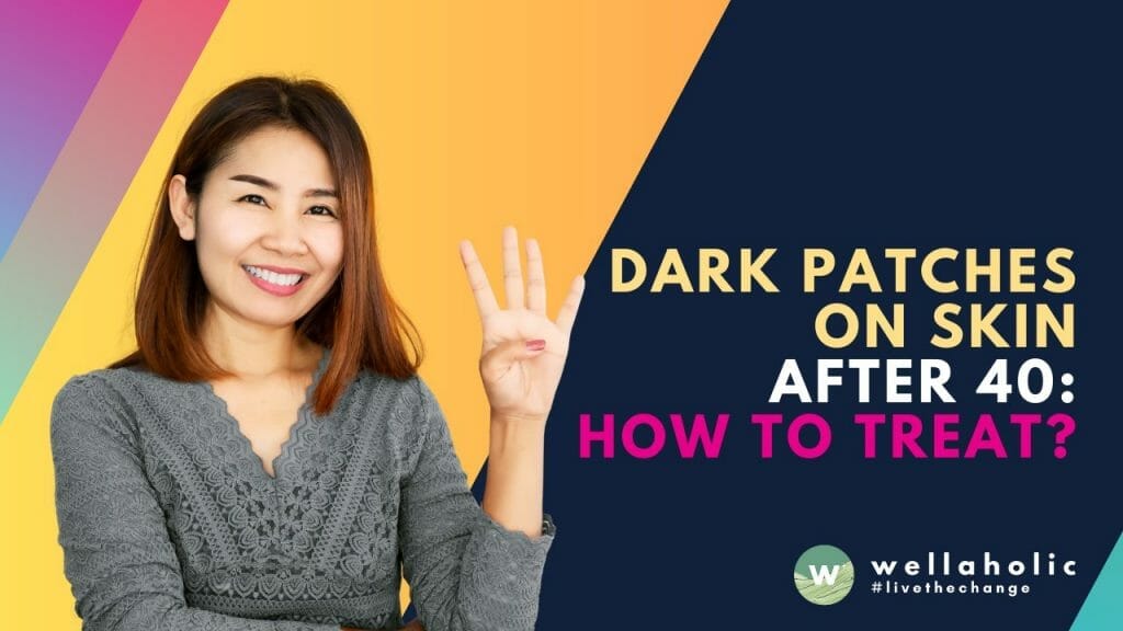 Dark Patches on Skin After 40 – Learn the Secret to Reducing Them