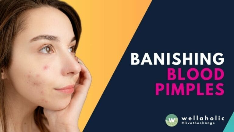 Join Wellaholic in the fight against blood pimples. Discover our expert treatments and prevention tips for clear, healthy skin. Click to learn more and transform your skincare journey