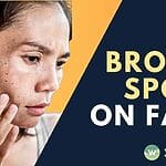 Discover effective methods for removing brown spots in Singapore. Learn expert tips and treatments to achieve flawless skin. Find out the secret now!