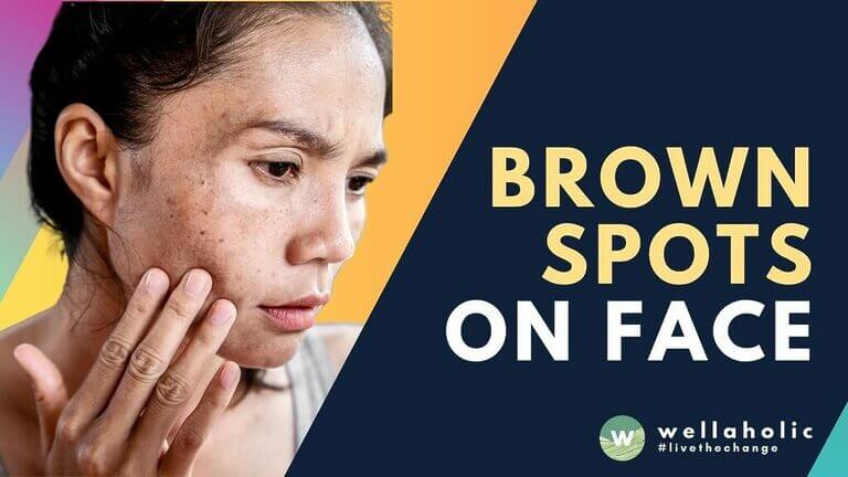 Discover effective methods for removing brown spots in Singapore. Learn expert tips and treatments to achieve flawless skin. Find out the secret now!