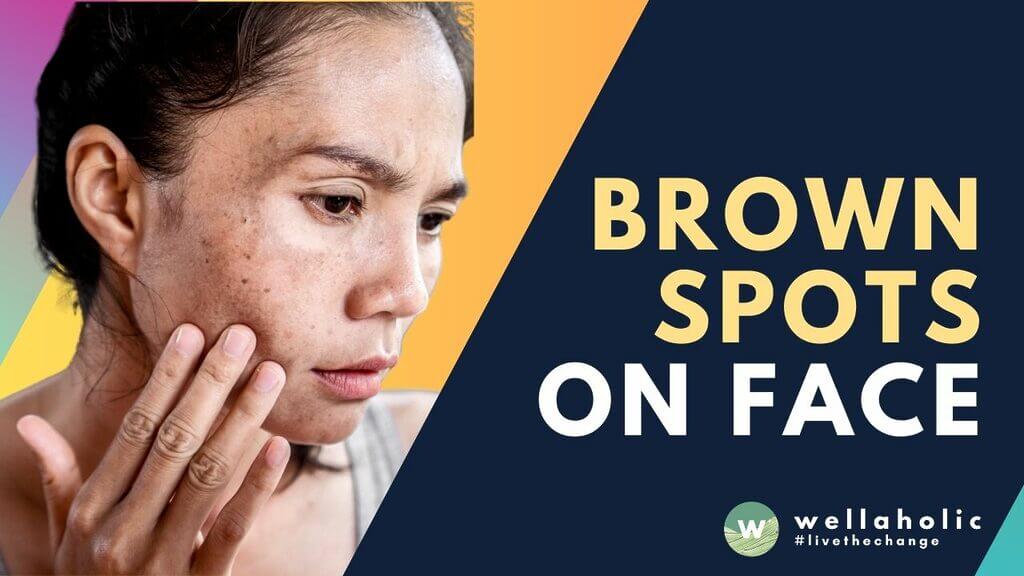 Discover effective methods for removing brown spots in Singapore. Learn expert tips and treatments to achieve flawless skin. Find out the secret now!