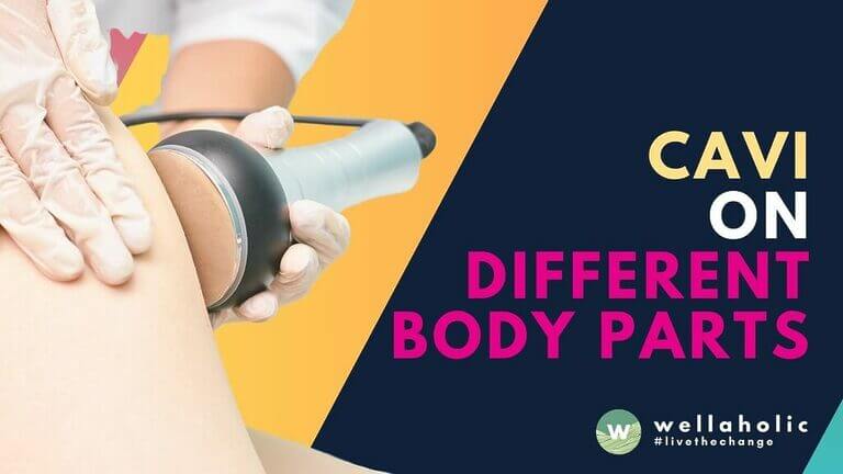 Discover the benefits of ultrasonic cavitation on different body areas like abdomen, thighs, and arms. Learn about non-invasive fat reduction treatment for optimal body contouring results.