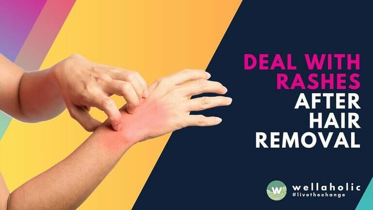 Prevent and treat pimples, rashes, or infection after intimate hair removal in Singapore with clear steps, gentle care, and smart aftercare routines. Learn what to do next and act today.