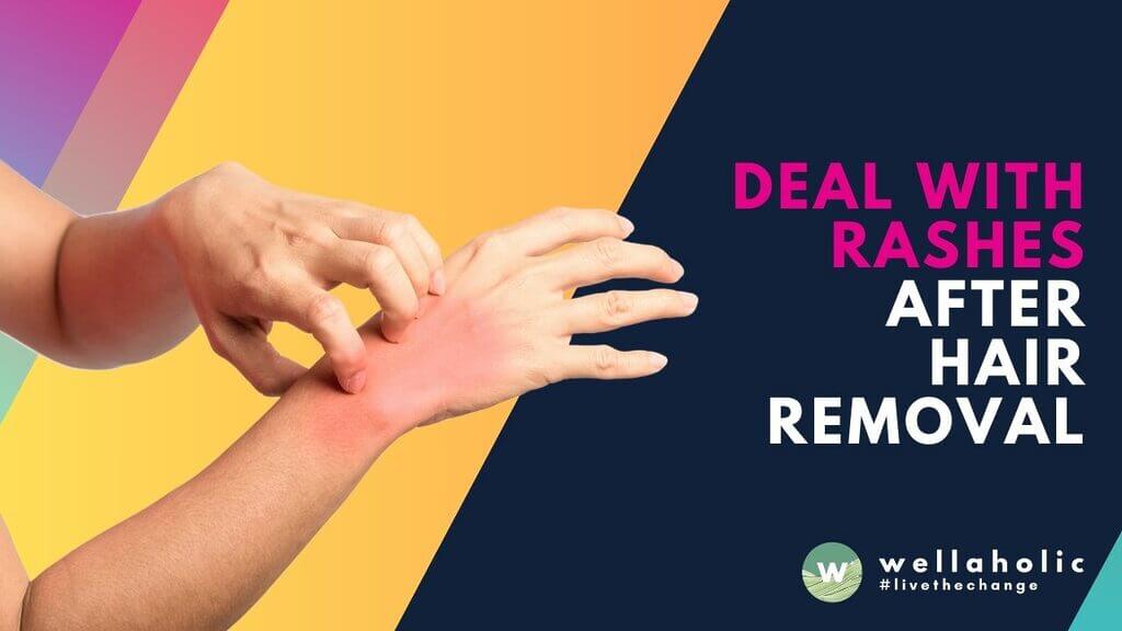 Prevent and treat pimples, rashes, or infection after intimate hair removal in Singapore with clear steps, gentle care, and smart aftercare routines. Learn what to do next and act today.