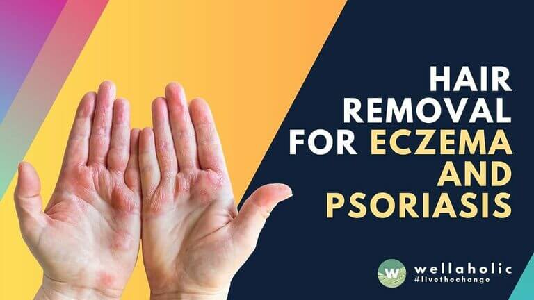 Discover safe hair removal solutions for eczema and psoriasis in Singapore. Wellaholic offers gentle SHR treatments designed for sensitive skin. Book your consultation today!