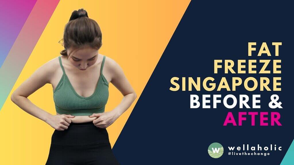 Discover the transformative effects of fat freezing in Singapore with real before-and-after results. Learn about the benefits, process, and outcomes of treatments like Wellaholic’s WellaFreeze™ 360.