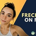 Discover the truth about freckles in Singapore. Are they a passing trend or a permanent feature? Dive in to explore their origins, care tips, and beauty secrets.