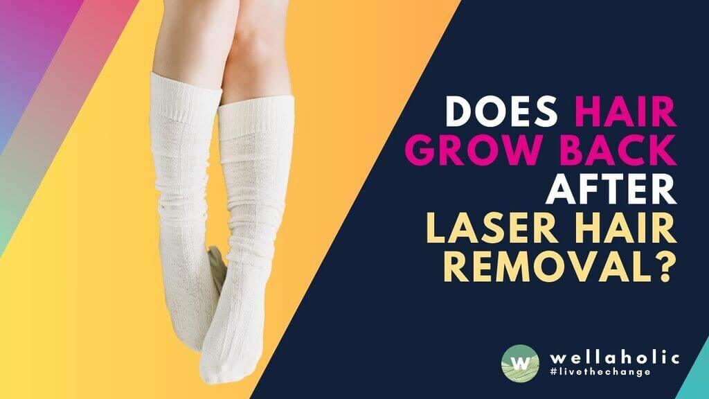 Wondering if laser hair removal is permanent? Find out how long it takes for hair to regrow after a laser hair removal treatment in this informative article.