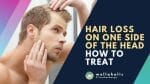 hair loss on one side