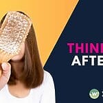 Discover why Asian women experience hair thinning after 40 and effective solutions in Singapore. Learn about hormonal changes, treatments, and prevention strategies. Book consultation today.