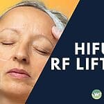 HIFU vs RF lifting in Singapore: clear 2025 guide on how each works, results, safety, and costs. Compare pros and cons with timelines, then get expert tips to choose confidently today.