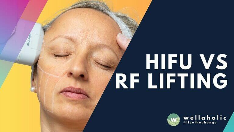 HIFU vs RF lifting in Singapore: clear 2025 guide on how each works, results, safety, and costs. Compare pros and cons with timelines, then get expert tips to choose confidently today.