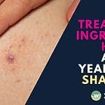 Discover effective solutions for treating ingrown hairs caused by years of shaving. Wellaholic's expert recovery plan helps repair damaged skin and prevent future irritation. Book today!
