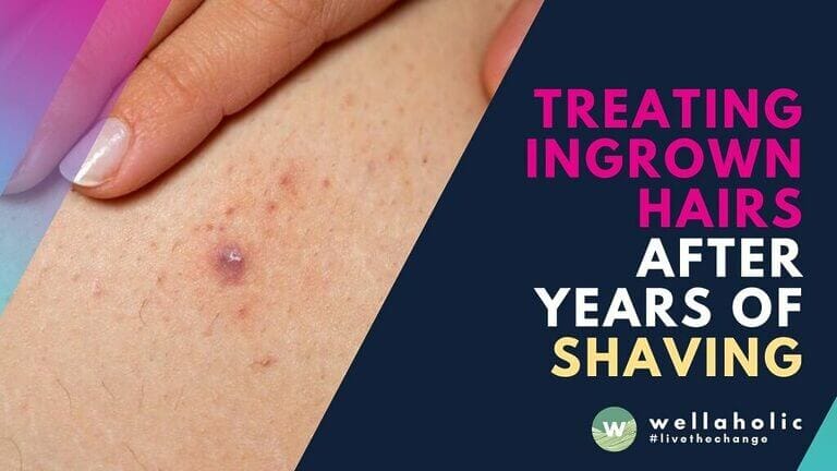 Discover effective solutions for treating ingrown hairs caused by years of shaving. Wellaholic's expert recovery plan helps repair damaged skin and prevent future irritation. Book today!