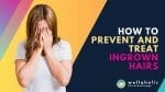 Learn how to treat and prevent ingrown hairs with our comprehensive guide. Discover the causes, effective treatments, and prevention strategies for ingrown hairs in Singapore. Say goodbye to this common concern and hello to smooth, irritation-free skin.
