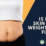 Yes, loose skin after weight loss is fixable in Singapore! Explore RF treatment vs. surgery options to tighten skin effectively. Discover solutions for a smoother silhouette and regain confidence. Learn more today!