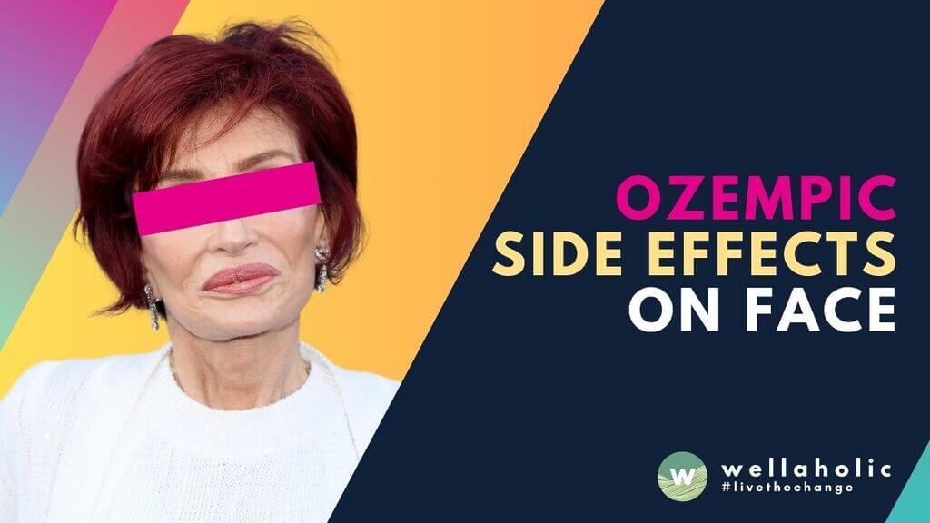 Experiencing Ozempic face? Learn how Singapore aesthetic clinics reverse facial volume loss with proven treatments. Get your youthful look back. Book consultation!