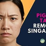 Clear skin in Singapore is achievable! Your ultimate guide to Pigmentation Removal treatments, costs, and results. Learn about effective solutions & book a consultation for a clearer complexion.