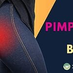 Discover effective strategies to eliminate butt acne by understanding the causes, treatments, and prevention methods. Get rid of butt pimples and prevent breakouts with expert tips.