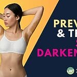 Learn how to prevent and treat post-hair removal hyperpigmentation with laser treatment options and skincare techniques to maintain healthy skin.