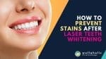 prevent teeth stains