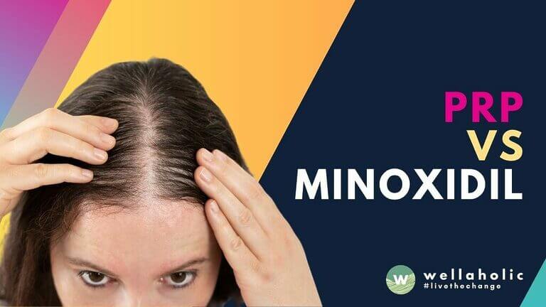 Compare PRP vs Minoxidil hair treatments in Singapore. Discover which solution delivers better results for hair growth with expert insights from Wellaholic. Book consultation today.